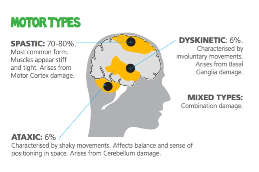 Types of Cerebral Palsy